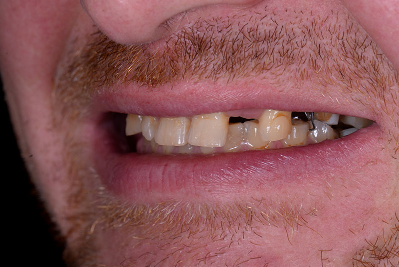 before dental procedure results