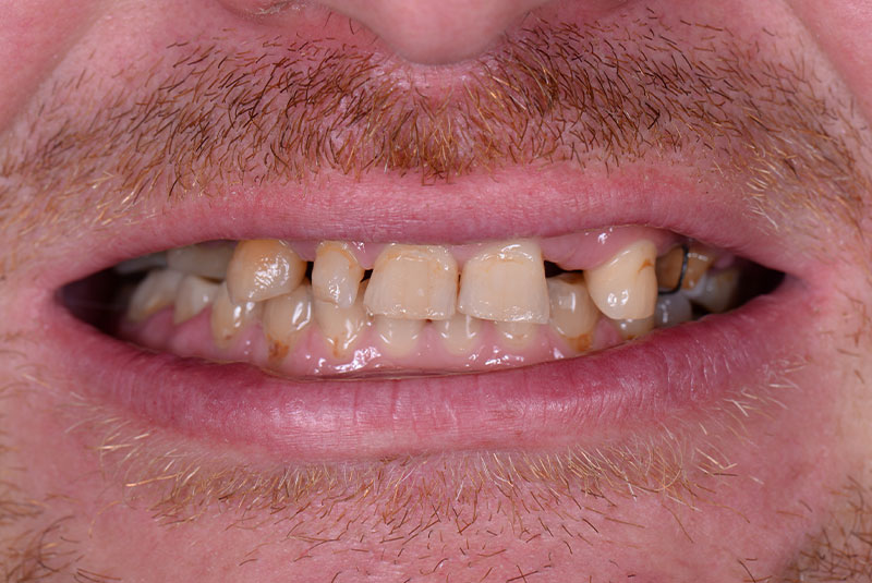 before dental procedure results